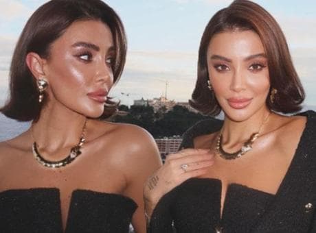 Özge Ulusoy’dan yıllar sonra estetik itirafı: Aslında gerek yoktu